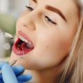 What Does a Dentist Do? A Comprehensive Guide