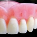 What is the Name of a Professional Who Does Dentures?