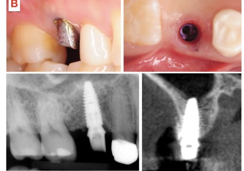 Why Are Dentists Unhappy? A Comprehensive Look at the Causes and Solutions