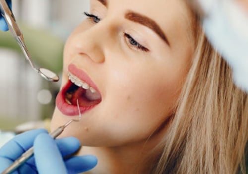 What Does a Dentist Do? A Comprehensive Guide