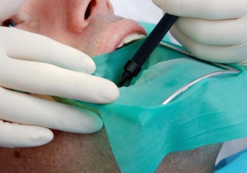 Can Dentists Perform Root Canal Treatments?